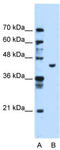 Phosphoglycerate Kinase 1 antibody, TA346534, Origene, Western Blot image 