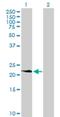 Platelet-derived growth factor subunit A antibody, H00005154-B01P, Novus Biologicals, Western Blot image 