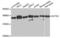 Dynactin Subunit 1 antibody, orb48350, Biorbyt, Western Blot image 