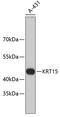 Keratin 15 antibody, 13-863, ProSci, Western Blot image 