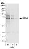 X-linked retinitis pigmentosa GTPase regulator antibody, A305-028A, Bethyl Labs, Western Blot image 