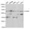 Potassium Calcium-Activated Channel Subfamily N Member 4 antibody, abx001608, Abbexa, Western Blot image 