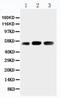 DNA/RNA-binding protein KIN17 antibody, PA5-79556, Invitrogen Antibodies, Western Blot image 