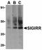 Single Ig And TIR Domain Containing antibody, orb74562, Biorbyt, Western Blot image 