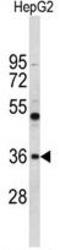 ELOVL Fatty Acid Elongase 2 antibody, GTX80506, GeneTex, Western Blot image 