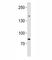Sal-like protein 4 antibody, F52987-0.4ML, NSJ Bioreagents, Western Blot image 