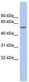 Preferentially Expressed Antigen In Melanoma antibody, TA333924, Origene, Western Blot image 