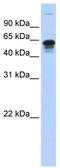 Regulator Of Microtubule Dynamics 3 antibody, TA342359, Origene, Western Blot image 