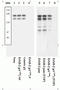 ERBB2 antibody, GTX25654, GeneTex, Western Blot image 