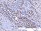 YY1 Transcription Factor antibody, M00833-1, Boster Biological Technology, Immunohistochemistry paraffin image 