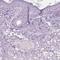 Galactose Mutarotase antibody, HPA035472, Atlas Antibodies, Immunohistochemistry paraffin image 