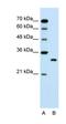SBDS Ribosome Maturation Factor antibody, orb330443, Biorbyt, Western Blot image 