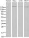 ERBB2 antibody, LS-C796709, Lifespan Biosciences, Western Blot image 