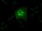 Solute Carrier Family 2 Member 6 antibody, NBP1-47987, Novus Biologicals, Immunocytochemistry image 