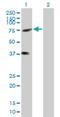Kinesin Family Member C3 antibody, H00003801-B01P, Novus Biologicals, Western Blot image 