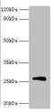 Rabies virus Matrix protein  antibody, orb241168, Biorbyt, Western Blot image 