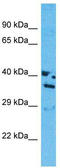 Olfactory Receptor Family 13 Subfamily J Member 1 antibody, TA332316, Origene, Western Blot image 