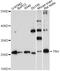 Prothyroliberin antibody, A01108, Boster Biological Technology, Western Blot image 