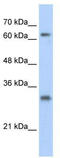Inactive ubiquitin-specific peptidase 39 antibody, TA343624, Origene, Western Blot image 
