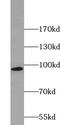 Zinc Finger Protein 606 antibody, FNab09719, FineTest, Western Blot image 