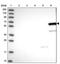 Zinc Finger Protein 45 antibody, PA5-58466, Invitrogen Antibodies, Western Blot image 