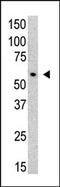 Protein Inhibitor Of Activated STAT 3 antibody, AP11248PU-N, Origene, Western Blot image 