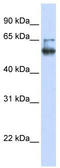 Membrane Bound O-Acyltransferase Domain Containing 7 antibody, TA338651, Origene, Western Blot image 