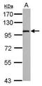 Solute Carrier Family 9 Member A8 antibody, PA5-31728, Invitrogen Antibodies, Western Blot image 