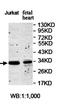 Anaphase-promoting complex subunit 10 antibody, orb78030, Biorbyt, Western Blot image 