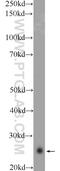 SERTA Domain Containing 1 antibody, 10167-1-AP, Proteintech Group, Western Blot image 