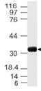 Uncoupling Protein 3 antibody, A01769, Boster Biological Technology, Western Blot image 
