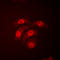p38 antibody, LS-C353960, Lifespan Biosciences, Immunofluorescence image 