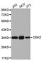 Cyclin Dependent Kinase 2 antibody, TA332744, Origene, Western Blot image 