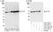 Chaperonin Containing TCP1 Subunit 8 antibody, A303-448A, Bethyl Labs, Western Blot image 