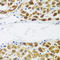 N(Alpha)-Acetyltransferase 60, NatF Catalytic Subunit antibody, A10429, Boster Biological Technology, Immunohistochemistry frozen image 