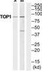 DNA Topoisomerase I antibody, TA312092, Origene, Western Blot image 