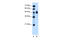 Indian Hedgehog Signaling Molecule antibody, 30-052, ProSci, Western Blot image 