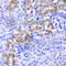 Lysosomal Associated Membrane Protein 1 antibody, A2582, ABclonal Technology, Immunohistochemistry paraffin image 