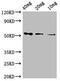 SARS CoV Nucleoprotein antibody, CSB-MA33255A1m, Cusabio, Western Blot image 