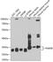 26S proteasome non-ATPase regulatory subunit 8 antibody, A12465, Boster Biological Technology, Western Blot image 
