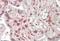 Max-like protein X antibody, orb20400, Biorbyt, Immunohistochemistry paraffin image 