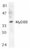 MYD88 Innate Immune Signal Transduction Adaptor antibody, SP1274P, Origene, Western Blot image 