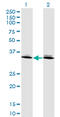Homeobox protein DLX-6 antibody, LS-C197059, Lifespan Biosciences, Western Blot image 