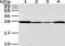 Ubiquitin C-Terminal Hydrolase L3 antibody, TA350569, Origene, Western Blot image 