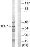 HEXIM P-TEFb Complex Subunit 1 antibody, TA312801, Origene, Western Blot image 
