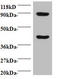 HCLS1 Associated Protein X-1 antibody, A51721-100, Epigentek, Western Blot image 