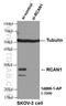 Dscr1 antibody, 14869-1-AP, Proteintech Group, Western Blot image 