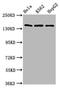 Splicing Factor 3b Subunit 1 antibody, CSB-PA021125LA01HU, Cusabio, Western Blot image 