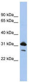 RAP1B, Member Of RAS Oncogene Family antibody, TA336122, Origene, Western Blot image 