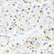 BRCA2 and CDKN1A-interacting protein antibody, 23-675, ProSci, Immunohistochemistry frozen image 